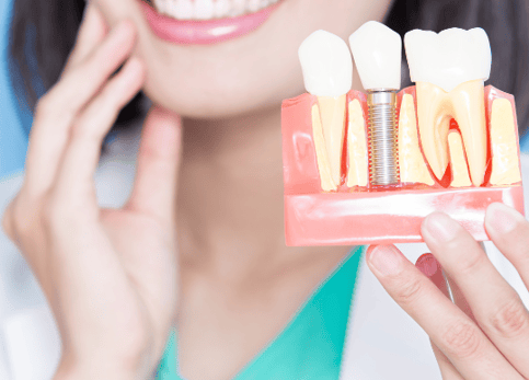 Dental Implantology