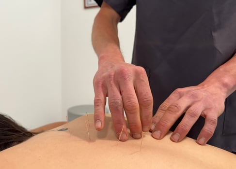 Aurelio_aplicando_tratamiento_de_acupuntura
