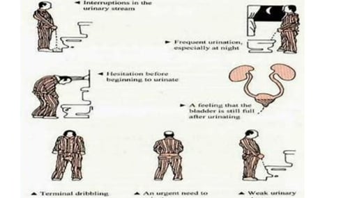 prostatitis