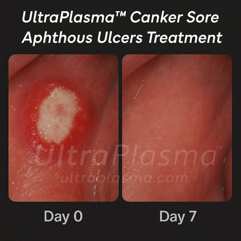 _ultra_plasma_ultra_plazma_ultra-plasma_ultra-plazma