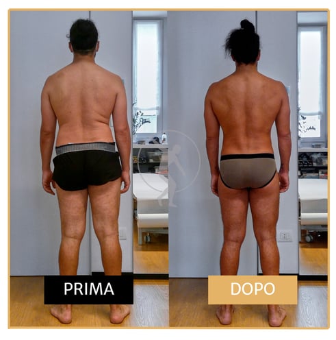 miglioramento posturale con il programma recovery by Performa Specialists Dott. Alessandro Rossin