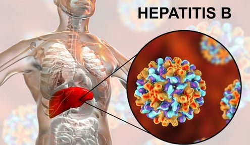 GASTRO FOUNDATION Hepatitis B