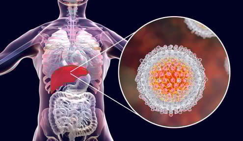 GASTRO FOUNDATION Hepatitis C