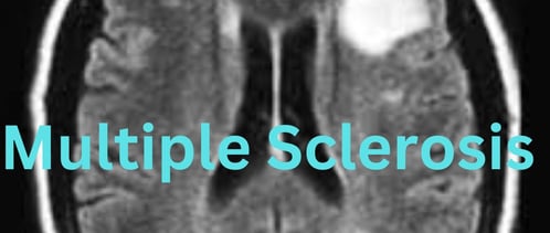 multiple-sclerosis and fasting