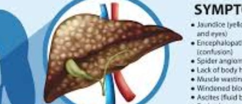 Fatty Liver Disease irreversable cirrosis
