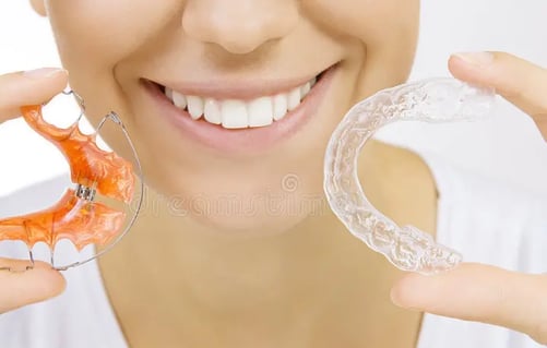 Retainer gigi di Sidharta Dental Studio Malang untuk menjaga hasil perawatan ortodonti