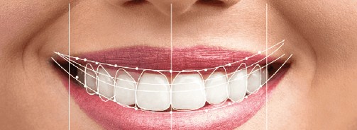 Dental Smile Design Treatment in Wadgaon sheri 