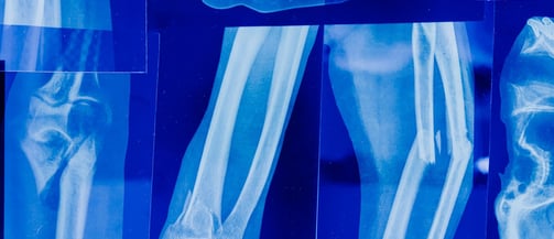 Xray dataset
