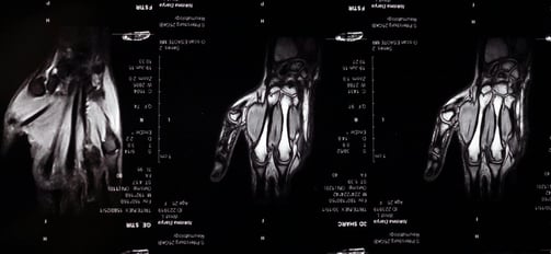 MRI dataset