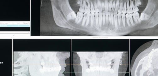 Dental dataset
