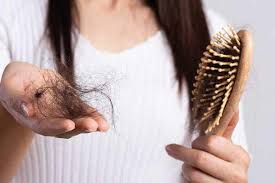 mulher exibindo em uma mão vários fios de cabelo - eflúvio telógeno