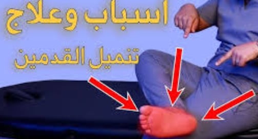 اسباب وعلاج تنميل القدمين