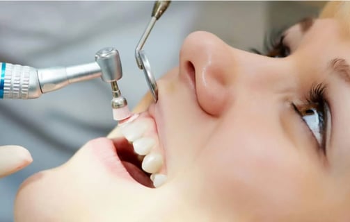 a child's teeth whitening is a great way to get ridded up