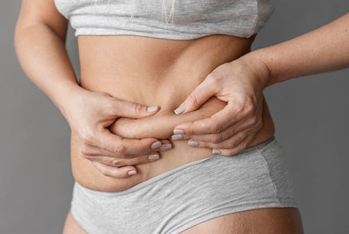 Mujer tomando grasa localizada en el abdomen