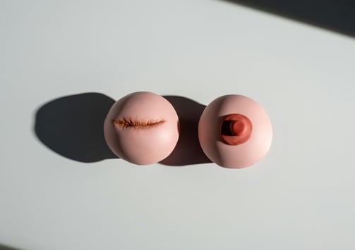 grieving breast from breast cancer with jihane laraichi