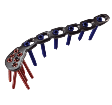 Placa para Clavícula para Extremidad Acromial