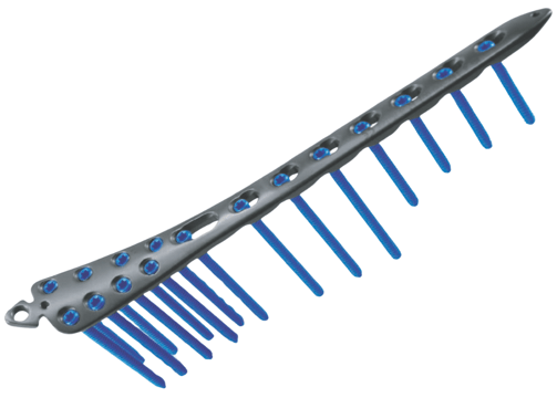 Placa para Tibia Distal Medial (Placa Talus)