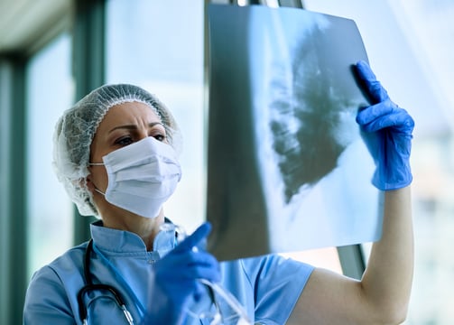 Nurse looking at the x-ray report