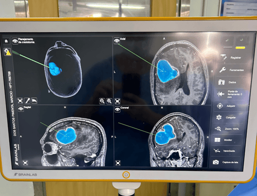 Francisco Torrao neuro cirurgião especialista em Nervos Perifericos e Plexo Braqueal no RJ 