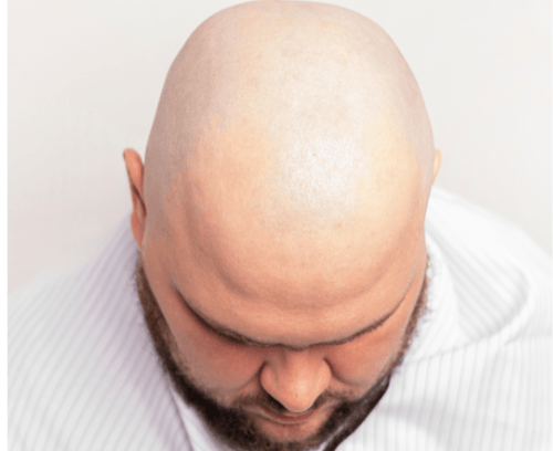 التحلل من الإحرام