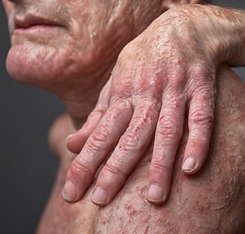 persons palm in close up photography