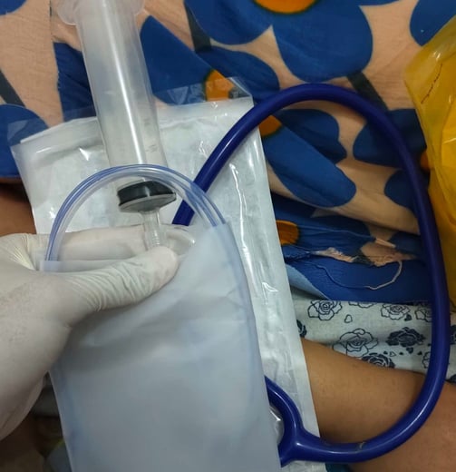 someone wearing gloves and holding a feeding tube