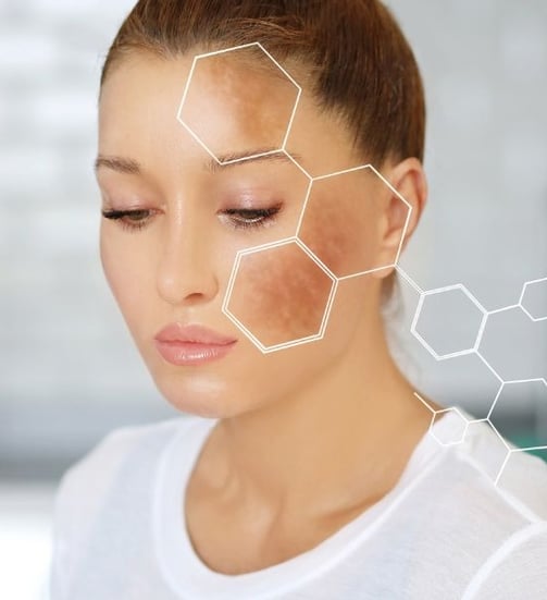 woman with dark spots on her face