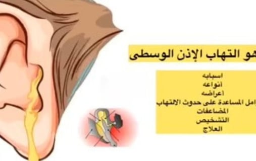 الاذن الوسطى الالتهاب