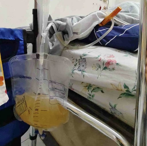 urine bag