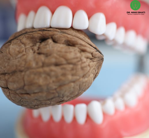 Healthy foods like greens, dairy, nuts, and fish, highlighting dental care tips for strong teeth and