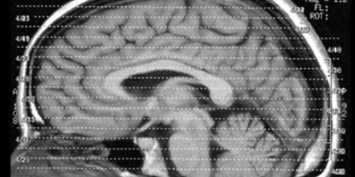 ct scan