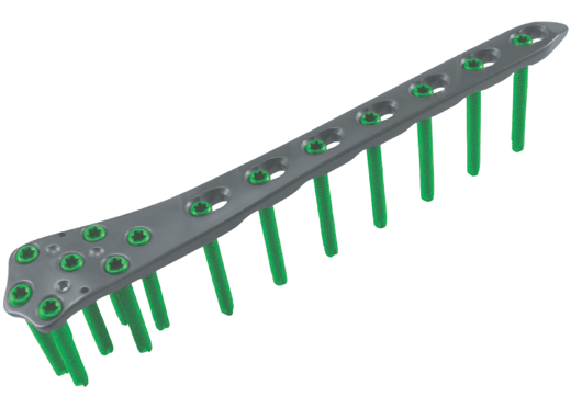 Placa para Fémur Distal Lateral Condilar (Placa Buttress)