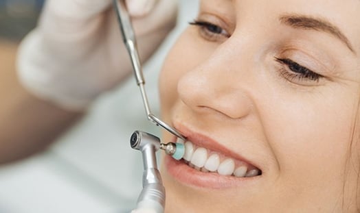 a woman is smiling for teeth cleaning