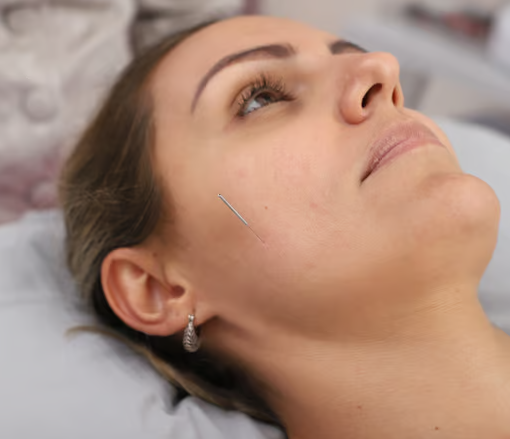 Dry Needling 