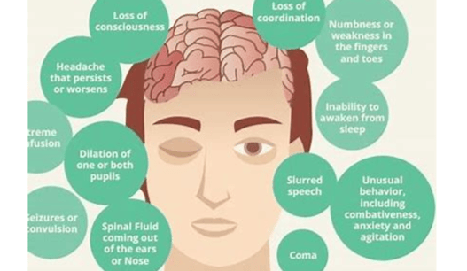 brain damage