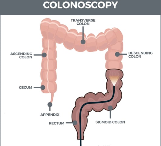 GASTRO FOUNDATION colonoscopy
