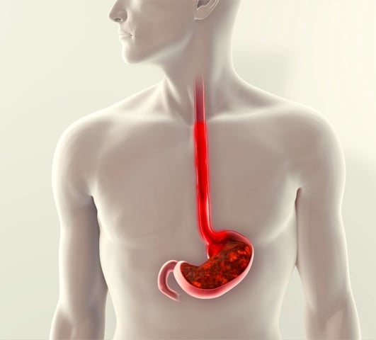 Upper GI endoscopy GASTRO FOUNDATION