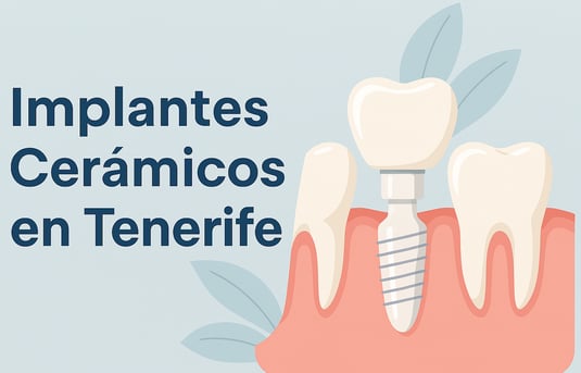 Implantes Cerámicos Tenerife