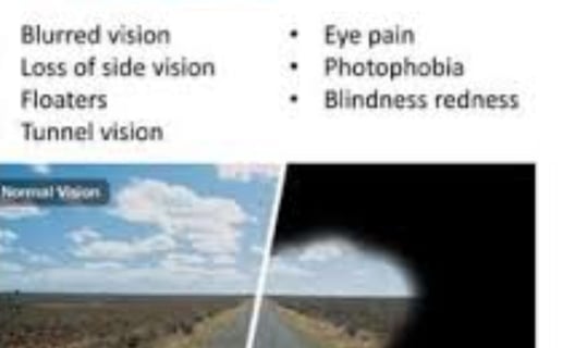 symptoms of RP