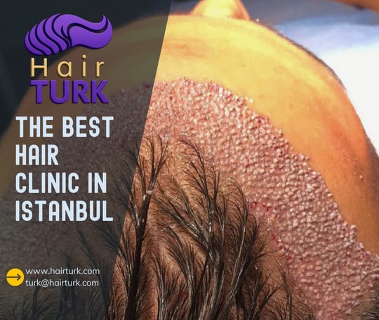 HairTurk, best hair clinic in Istanbul, showing hair transplant procedure with scalp and new growth