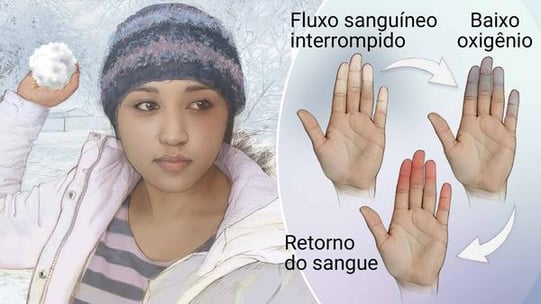 menina segurando uma bola de neve e no detalhe dedos das mãos congeladas 