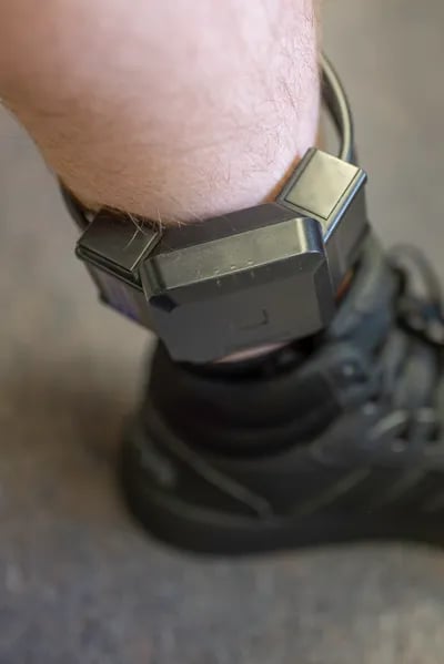 GPS ankle monitor on a client's leg for monitoring.