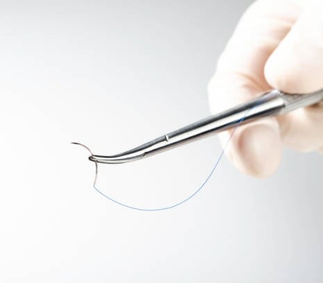 medical device.jpg