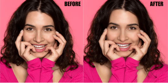 teeth-whitening-and-eye-correction