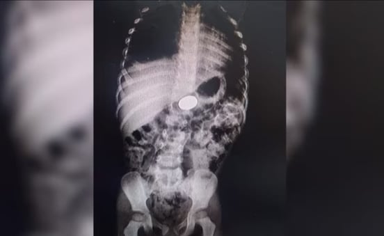 a dog's chest and chest x - ray image of a dog's