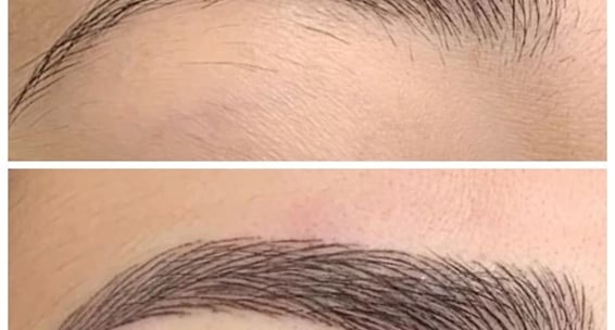 Skindent's Rejuvenate Eyebrows Microblading Services