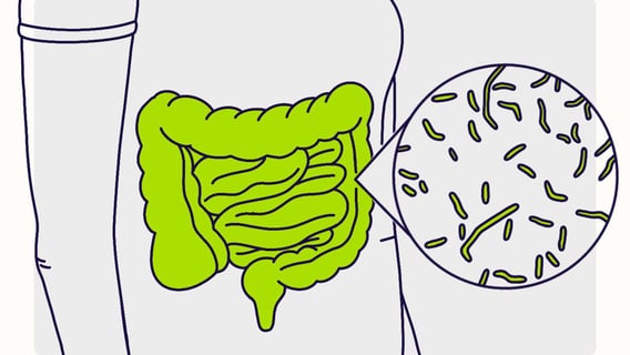 chronic diarrhea GASTRO FOUNDATION
