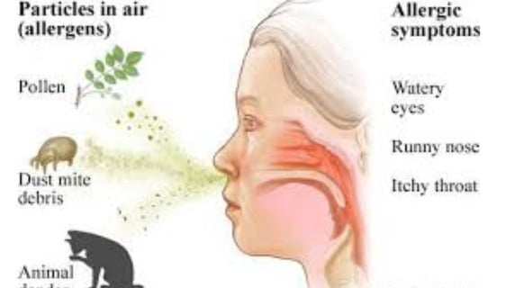 Dr. Hassan Al Warraqi's Approach to Disease Treatments sneezing