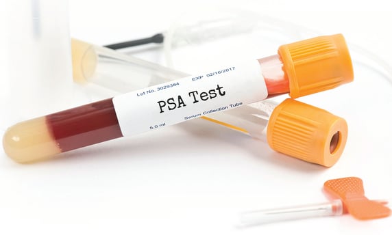 PSA Nedir? Prostat Sağlığı İçin Önemi ve Test Sonuçları