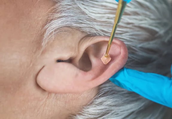 La réflexologie auriculaire